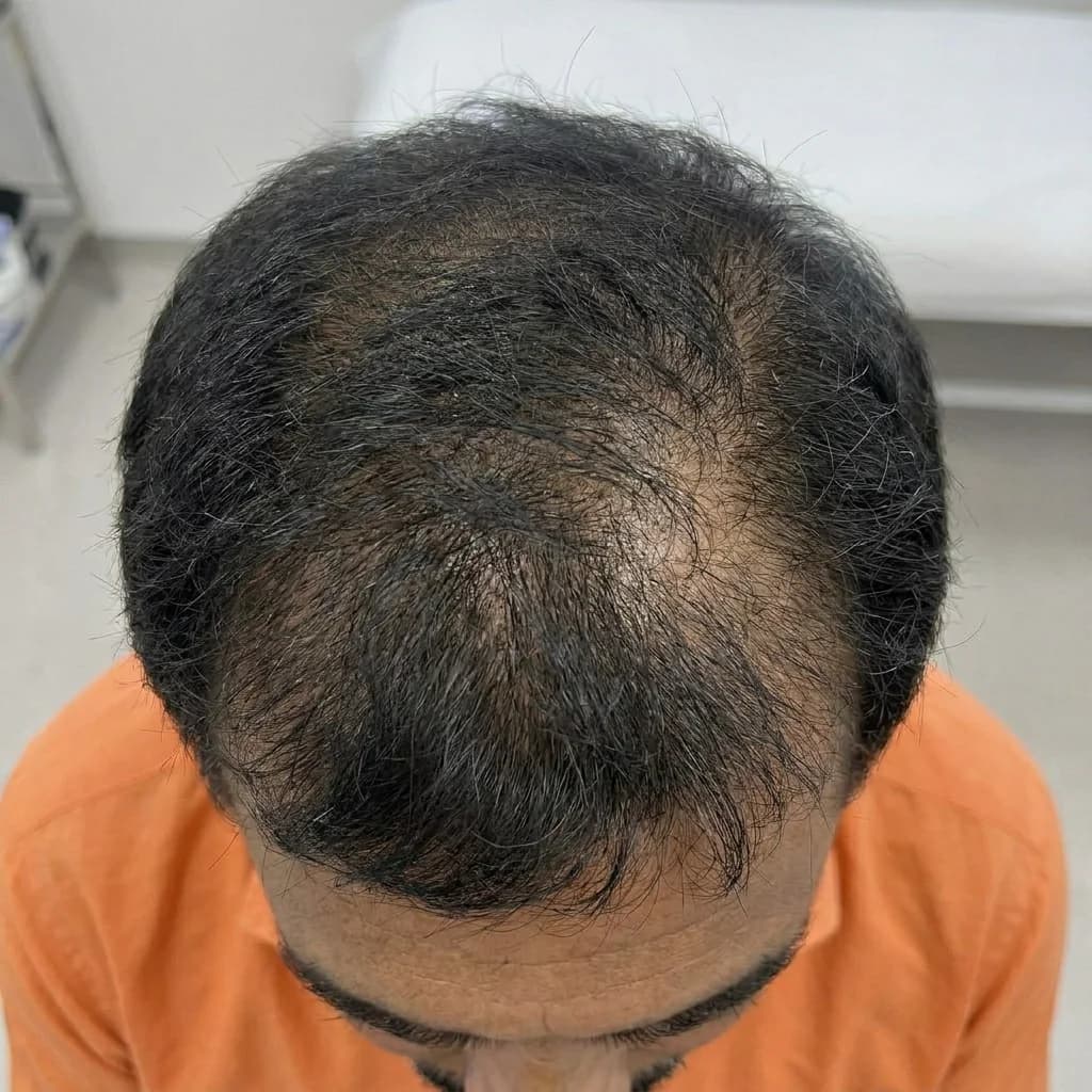 After
