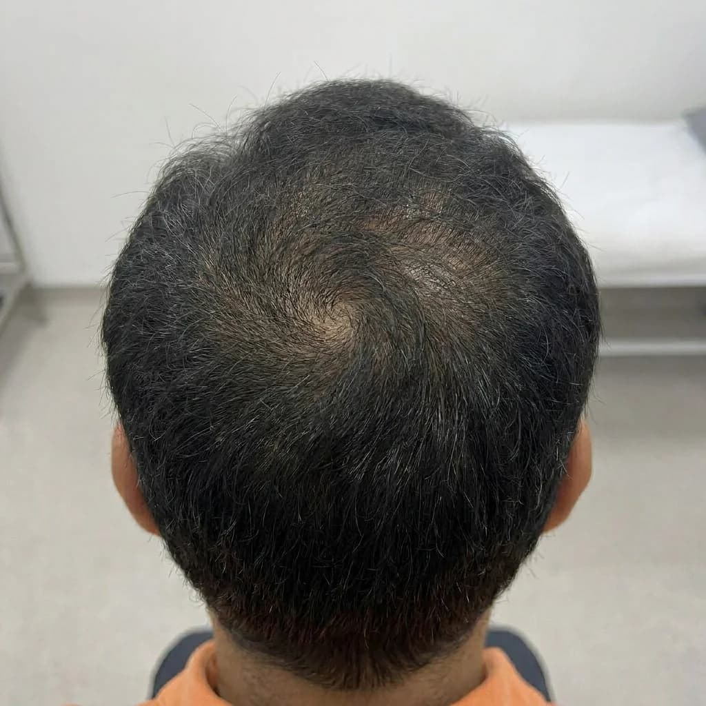 After
