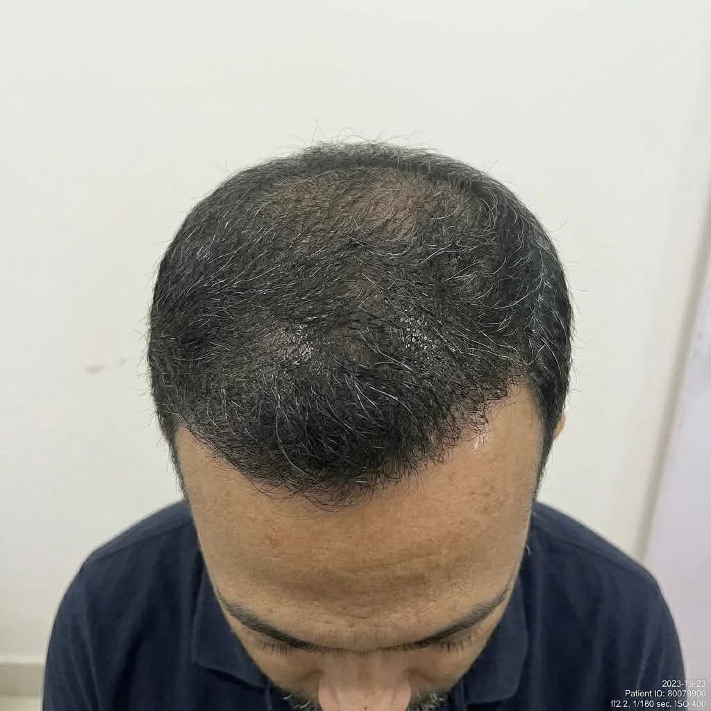 After