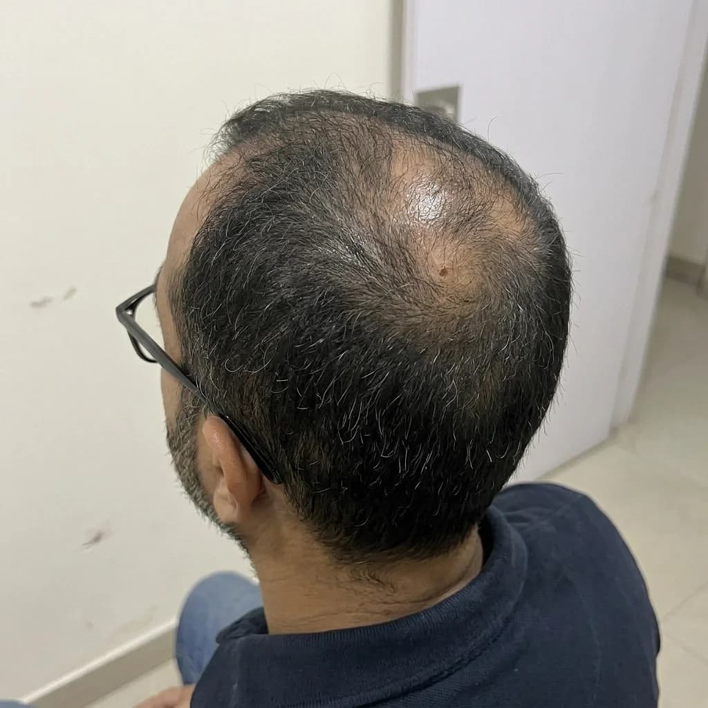 Before